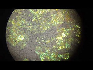 congo red birefringence