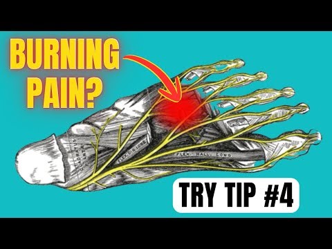 Morton's Neuroma: 5 Tips for Relief (No One Talks About #4)