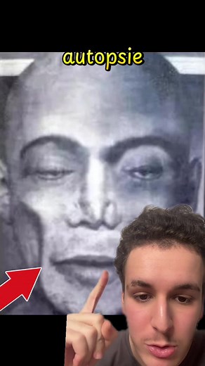 Michael Jackson après son autopsie : révélations incroyables