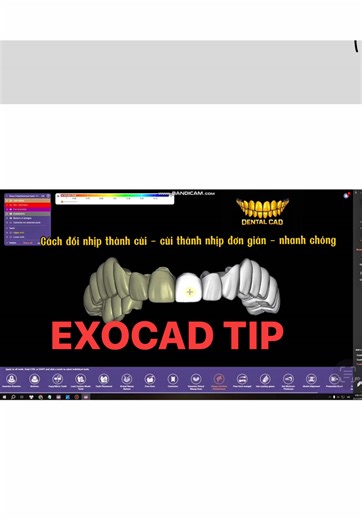 Cách đổi nhịp thành cùi - cùi thành nhịp exocad *#exocad #dentallab #exocad_tips_tricks #exocad_design#xuhuong