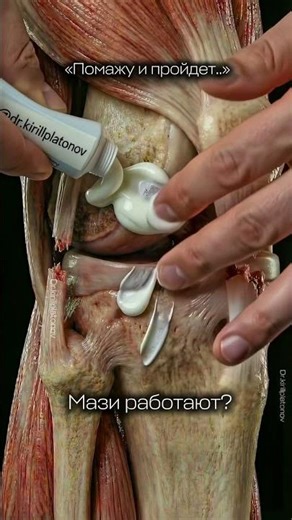 МАЗИ ДЛЯ КОЛЕНей. Боль в коленях.