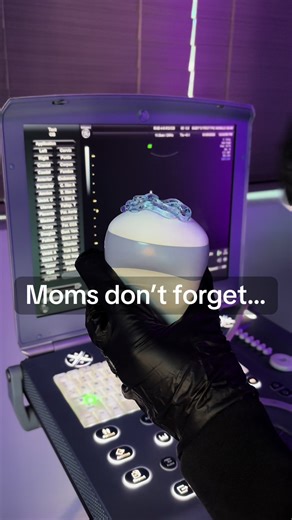 BOOK YOUR FREE 2D SCAN ✨ #expectingmom #2dultrasound #sonography #soontobemom #xyzbca