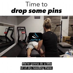 It’s Time for Dry Needling! . What is it ? Dry= without medication...