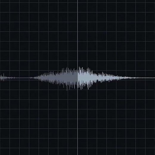 Fine Crackles Recording & Waveform | Eko Health