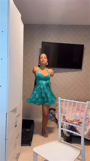 She lost both arms and one leg but she's a true example of overcoming adversity! 🙌🏼