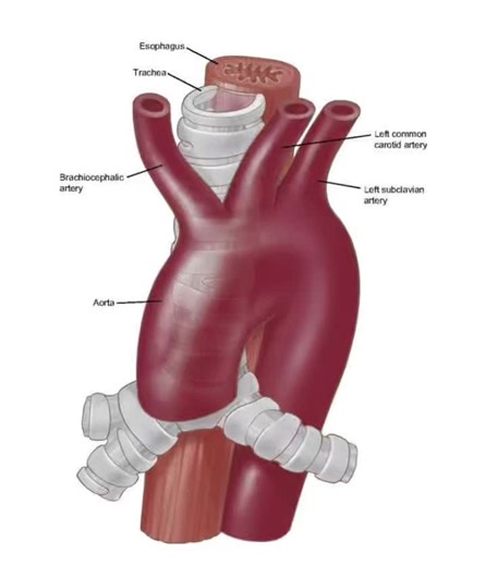 YT: Taim Talks Med. The aorta is the largest artery of the body and carries blood from the heart to the circulatory system. It has several sections: The Aortic Root, the transition point where blood first exits the heart, functions as the water main of the body. #fyp #f