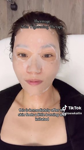 Skin Tightening Therapy with Thermage Treatment