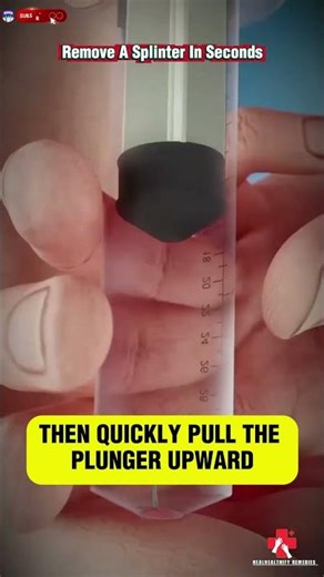 The Smartest Way to Remove a Splinter (No Tweezers Needed!)