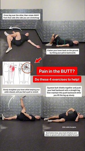 Piriformis Syndrome - Fix Your Butt Pain