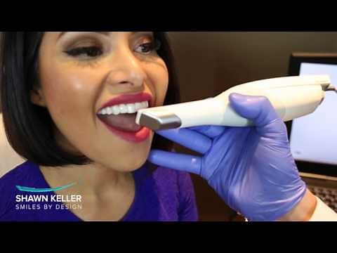 The Trios Scanner Provides Precision 3D Scan of Your Teeth.