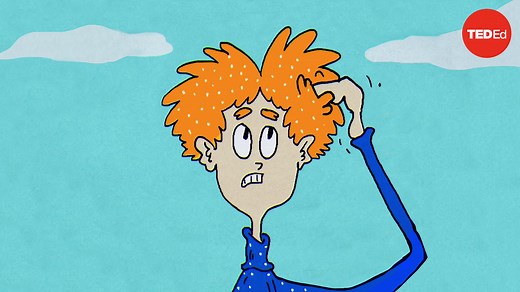 What causes dandruff, and how do you get rid of it?