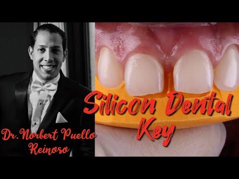 Silicone dental key. Direct palatal index composite. Dr. Norbert Puello Reinoso