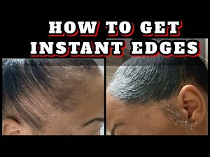 HOW TO APPLY *YOU GOT EDGES* EDGE CONTROL | NO EDGES TO INSTANT EDGES | Severe Alopecia