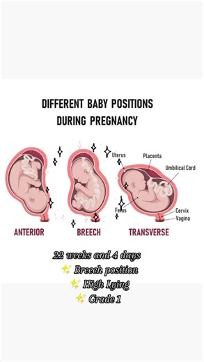Baby Position at 22 Weeks: Understanding Fetal Movement