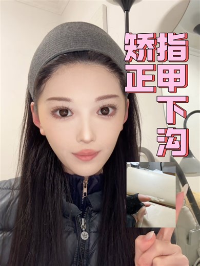 指甲下勾矫正 今天完成了过年三件套之一——美甲 这次美甲师用了一种我没体验过的方法把我的指甲下勾给解决了会比直接剪掉贴甲片的矫正作用好一些 有类似情况的朋友做美甲的时候可以让美甲师这样操作一下