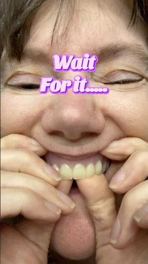 Taking out my dentures