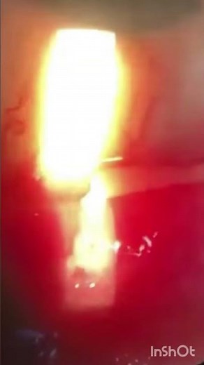 Slit lamp examination || Optometry With Shahid ||