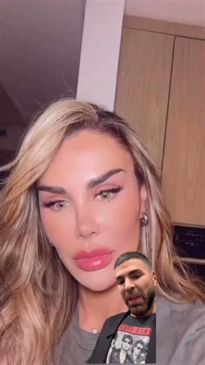 Ninel Conde se hizo el cambio de color de ojos permanente en la ciudad de NY El cambio permanente de color de ojos se llama queratopigmentación. Este procedimiento quirúrgico utiliza un láser para crear un microtúnel en la córnea y luego inyecta un pigmento para modificar el color original del ojo de forma permanente! RIESGOS: Aunque se considera una técnica para cambiar el color de forma permanente, existen riesgos asociados, como posibles infecciones, reacciones alérgicas, daños en la córnea, 