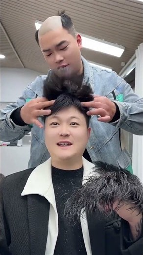 HuaiBei Invisible Hair Transplant #HuaiBei Hair Transplant #Hair Transplant