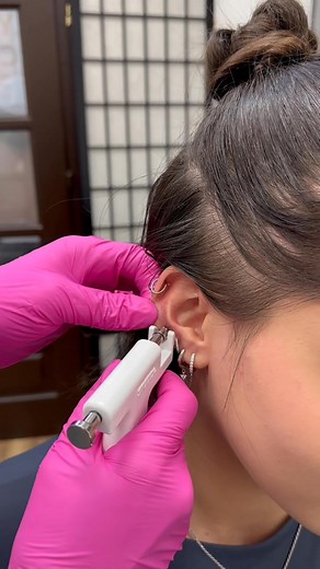 Studex Universal fülbelövés😇 Sokan kérdezitek, hogy melyik rendszerrel érdemes fülbe lövetni, szóval itt egy mini gyorstalpaló: 💥 Studex Universal A klasszikus “rugós” módszer. Gyors, hangosabb, és nagyobb erővel juttatja be az ékszert a fülbe. Felnőtteknek ez is teljesen tökéletes módszer. 🎯 System 75 A modernebb, precízebb megoldás. Csendesebb, kíméletesebb, és a tű élesebb benne. Gyermekeknek kizárólag ezzel a készülékkel készítem a fülbelövést. Jelentkezz be⤵️ www.fulcimpalyukasztas.hu/#i