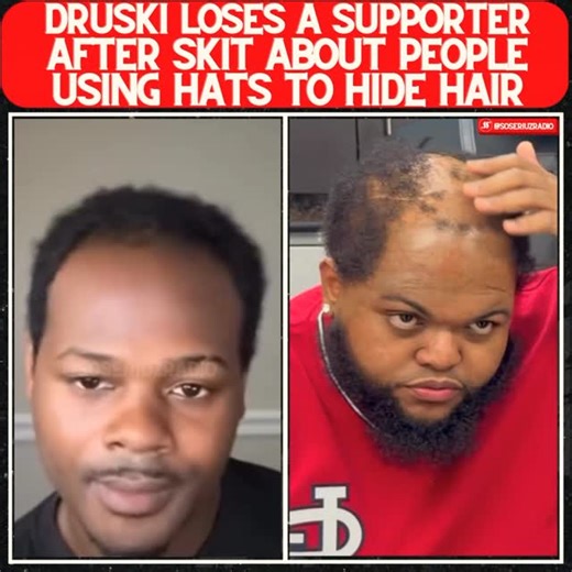 SSZRADIO ©️ | Druski loses a fan after his skit about people hiding hair with hats 😨 Thoughts 🤔⬇️ #druski #balding #fyppp | Instagram