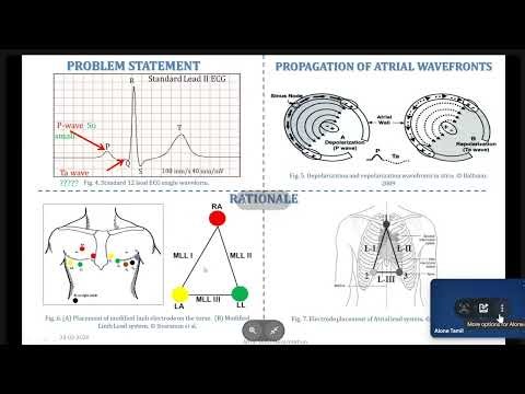 Advances in ECG Recording | Revolutionizing Heart Health Monitoring