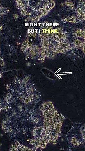 Eye Boogers Under Microscope #microscope #science #iris