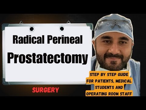 What to Expect for Radical Perineal Prostatectomy Surgery 😳(Step by step guide) Must 👀 ❤️