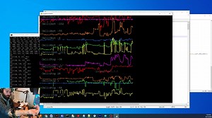 Forearm Muscle Contraction Sensor Is Useful Component For Open Source Prosthetics