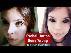 Eyeball Tattoo Gone Wrong Infection, Risks & Danger Guide