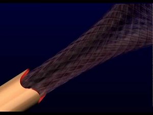 PTC Creo - Simulating Fluid Flow