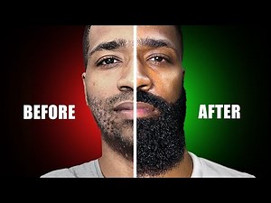 watch this if you have a patchy beard (science based)