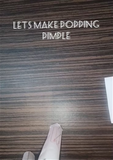 diy popping pimple!🎀❤️ #creativity #pimplepopping #diy