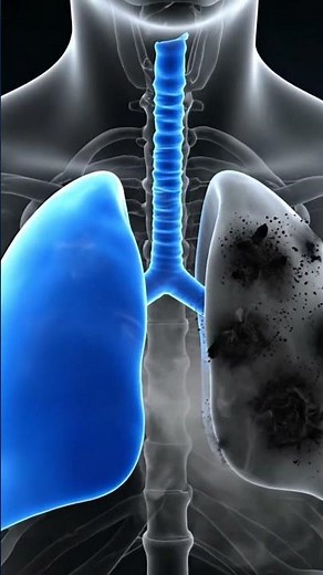 Smoke Damage – What Happens Inside Your Lungs | 3D Transparent Anatomy