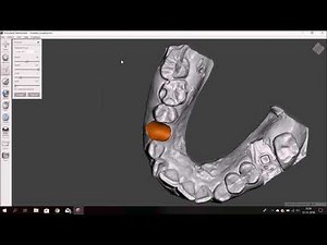 Meshmixer Tutorial 7 en español Eliminacion de una pieza dentaria