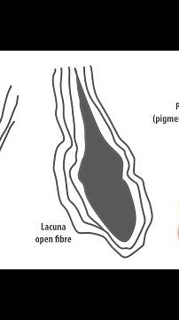Types of Lacunae in the iris