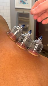 Cupping therapy uses suction to create space between layers of skin, fascia, and muscle—helping increase blood flow, reduce inflammation, and promote healing. It’s an ancient technique still used today for recovery, relaxation, and pain relief. #CuppingTherapy #SportsRecovery #FascialHealth #MoveBetter 🏆 | Dr_kyleross