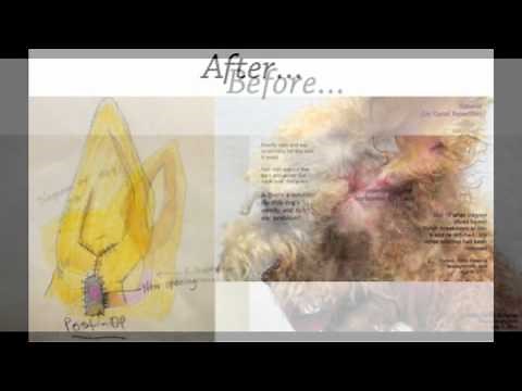 Lateral Canal Resection Surgery