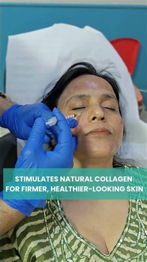 Refresh your skin with Face GFC + Microneedling