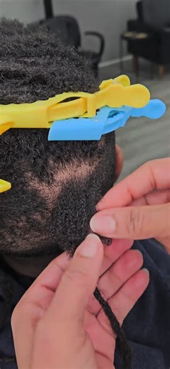 Effective Loc Repair Techniques for Loose Hair