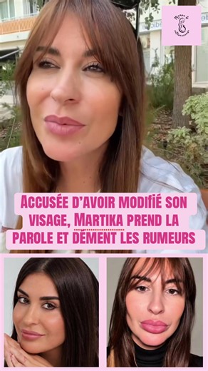 #martika #chirurgie