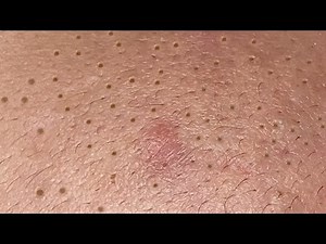 Satisfying Relaxing with Sac Dep Spa Video (#119) #SacDepSpa