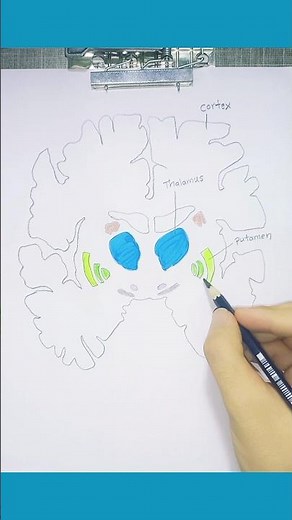 Basal Ganglia of Brain (Basal Nuclei of Brain) #anatomy #brain_anatomy #neuroanatomy