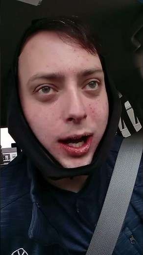 wisdom teeth extraction !! I need to go workout!!!