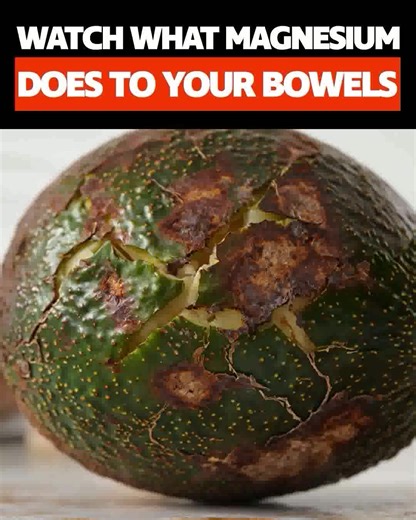 See how Emma powerfully helps: ✔️Restore regular bowel movements ✔️Reduce painful bloating and constipation ✔️Crush unwanted food cravings and fight harmful gut bacteria Discover EMMA Now! | Emma