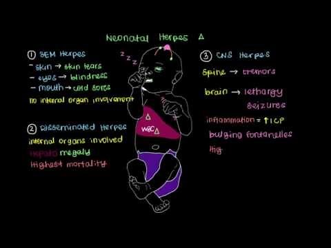 What is Neonatal Herpes?