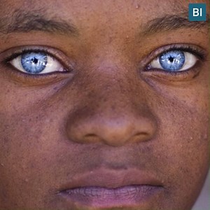 25K views | The reasons behind Africans with blue eyes | Business Insider Africa | Facebook