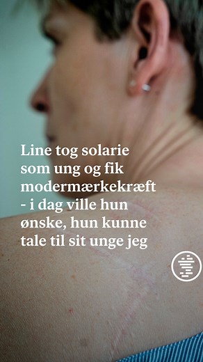 Hvordan fortæller man sine børn, at mor er syg? 💔 Line Lilholt var 38 år, da hun fik konstateret modermærkekræft i 2005 - efter flere år uden solcreme og med utallige solariebesøg. I dag fortryder hun, at hun ikke tænkte sig en ekstra gang om. - Folk siger: "Vi lever kun en gang", og så tænker jeg bare: "Ja, men måske jeres liv så bliver kortere", fortæller Line, hvis børn var 10 og 13 år gamle, da hun fik diagnosen. I dag ville hun ønske, at hun tidligere havde lært at elske sin lyse hud ❤️‍🩹