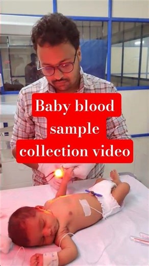 Baby blood sample collection method | Warning: Sensitive viewers may find this uncomfortable.