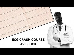 ECG CRASH COURSE- AV Blocks